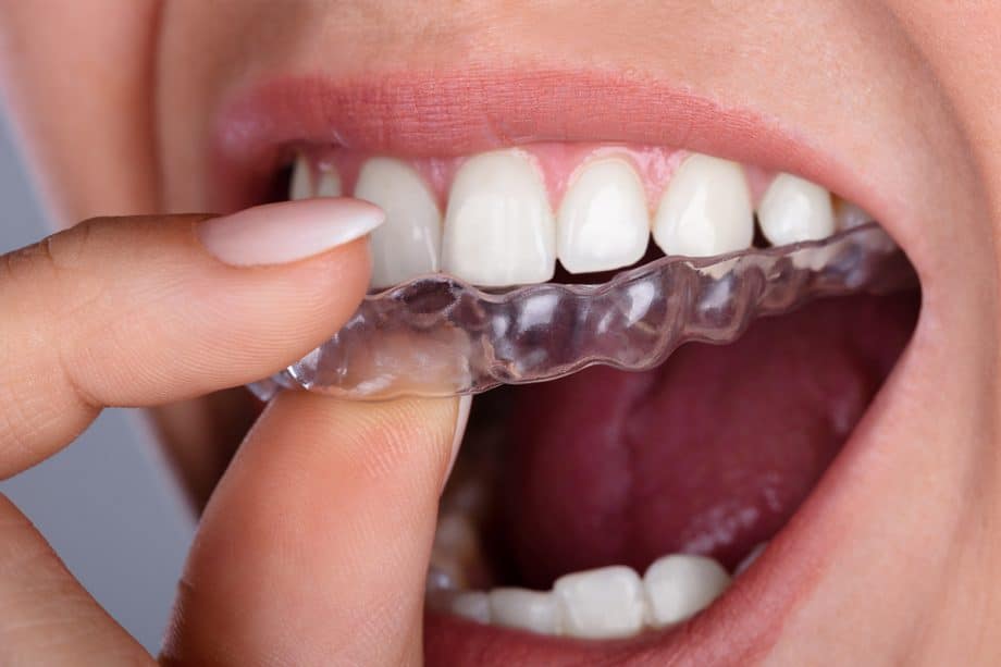 Adult Invisalign or Braces in Clifton, NJ | Paramount Dental