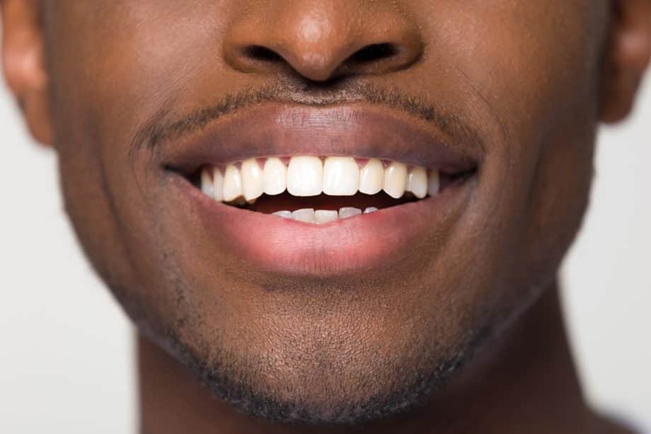 How Do You Whiten Sensitive Teeth?
