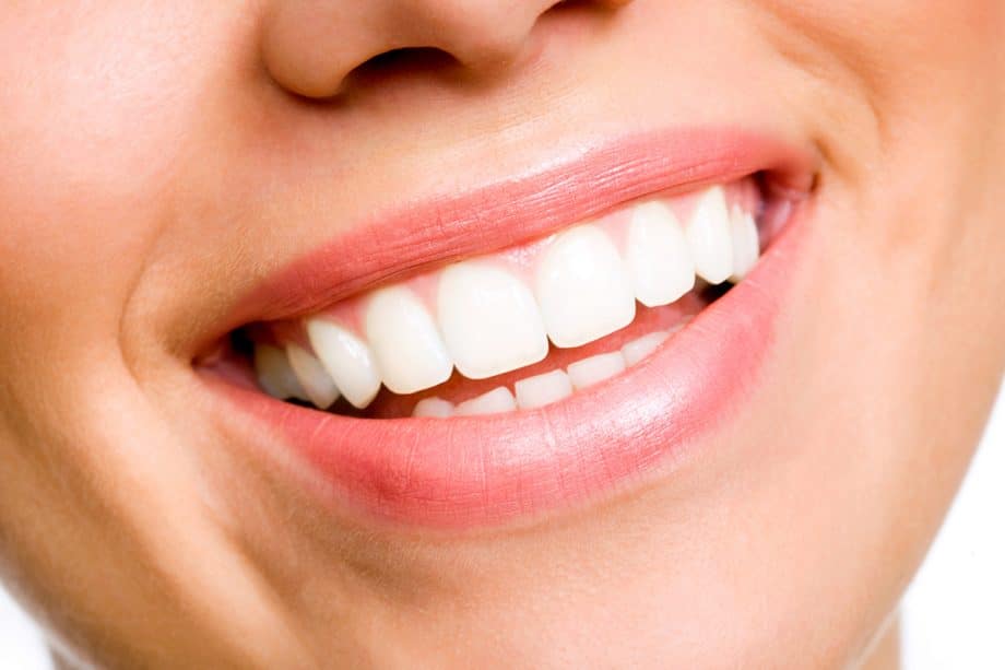 How Much Is Teeth Whitening In Clifton, NJ?