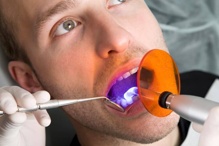 How Solea Laser Technology Makes Anesthesia-Free Fillings Possible
