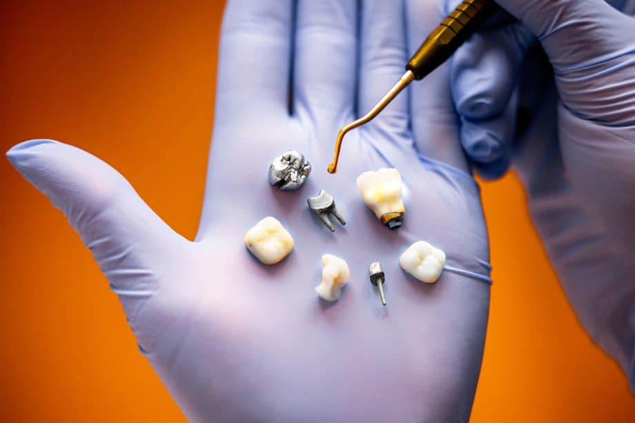 What to Expect When Getting a Dental Crown in Clifton, NJ
